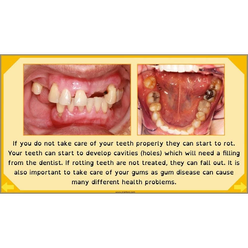 Eating and Digestion - Image 6